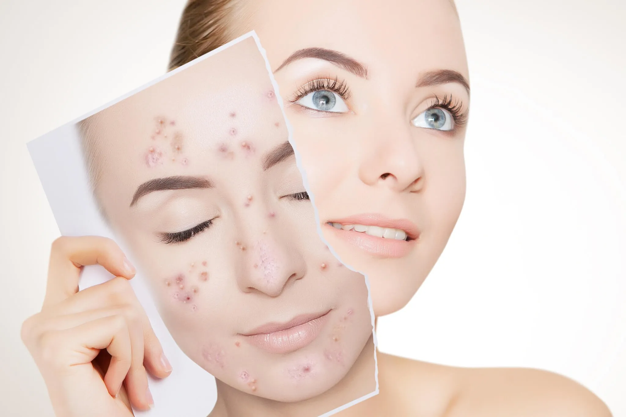 Dermatologist 