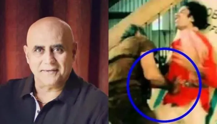 Coolie' Accident: When Puneet Issar