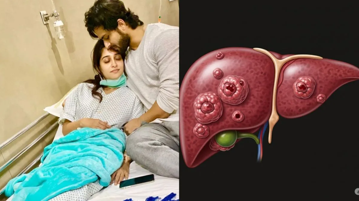 लिवर कैंसर 