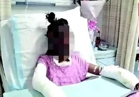   the incident of 14-year-old girl trying to popcorn on YouTube