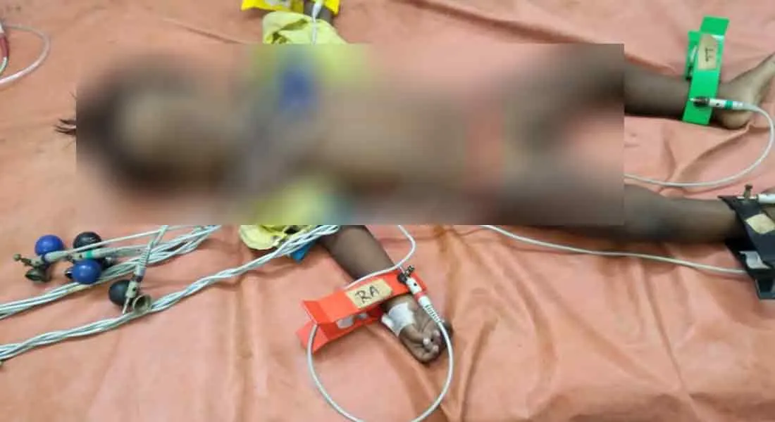  2 year old baby dies after eating rat killing biscut of as biscuits
