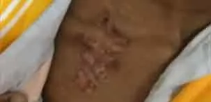  Red Acid in the name of hereditary remedies ... schoolgirl who was paralyzed at home!