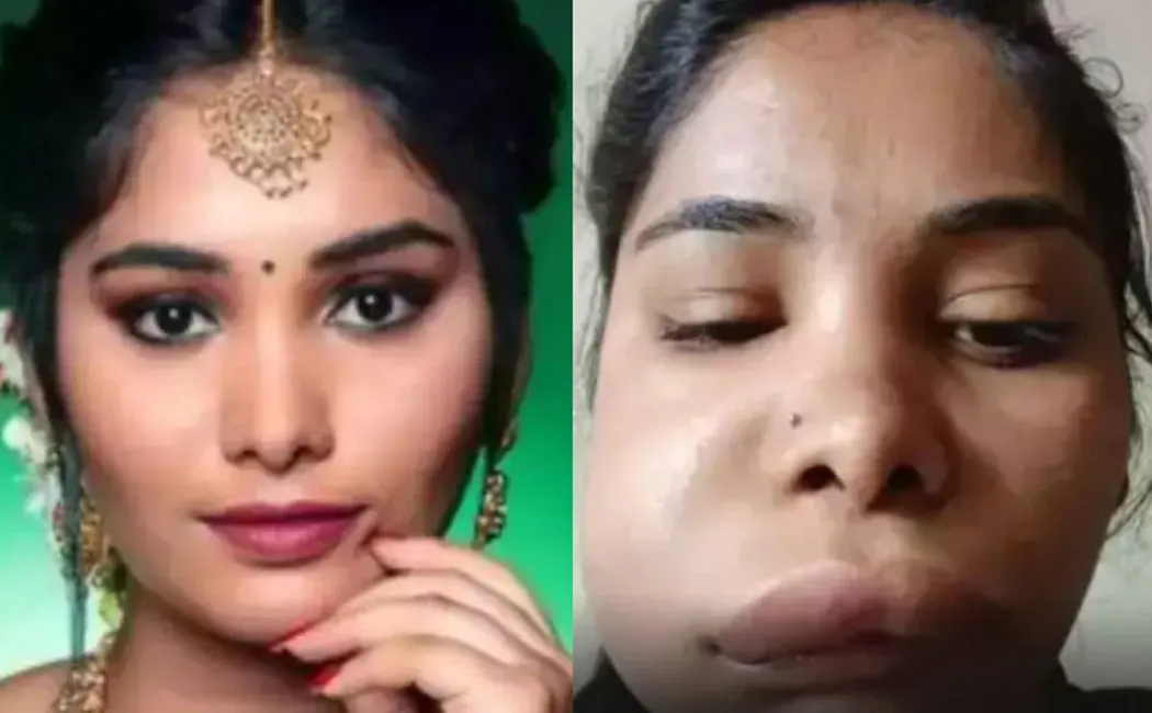Kannada Actress Swathi Swollen Face After Taking Treatment For Tooth