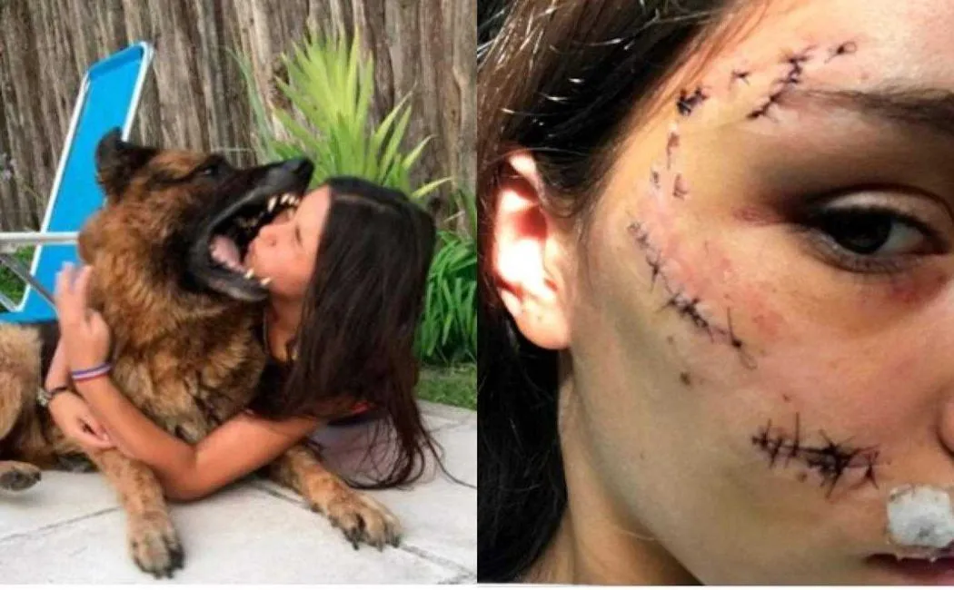 german shepherd attack argentina girl