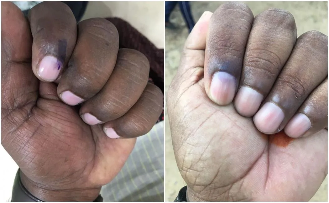 local body election-Complaints that voter ink destroyed in minutes