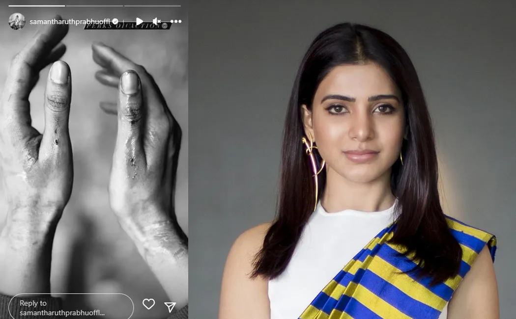 samantha hand injury while workout 