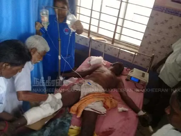 worker's foot is cut