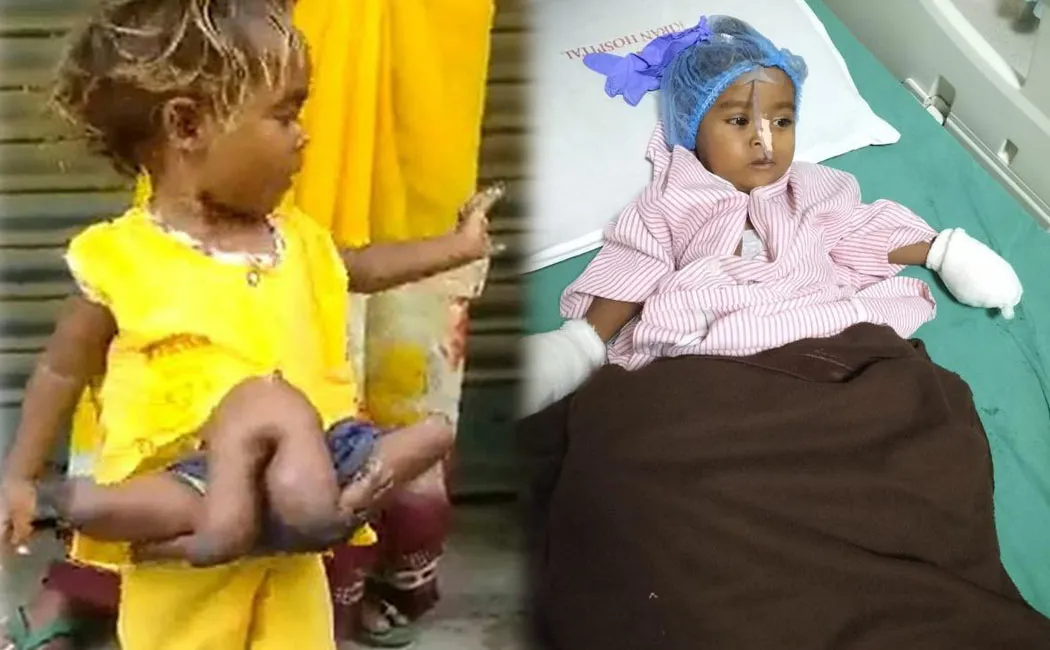 Sonu Sood has helped the Bihar 4 arms and 4 leg girl