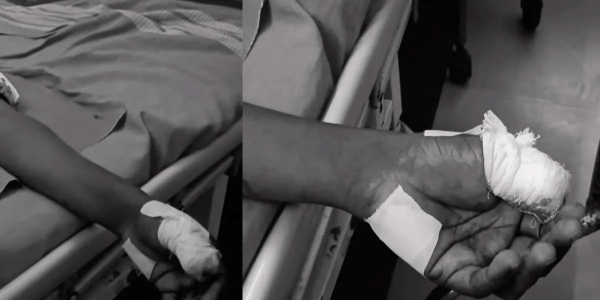 Missing AIADMK leader's finger; Police net for biting and spitting