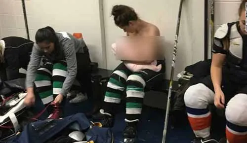 breast