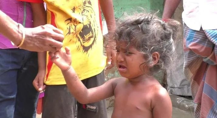 monkey Bite More than 40 people in chithamparam 
