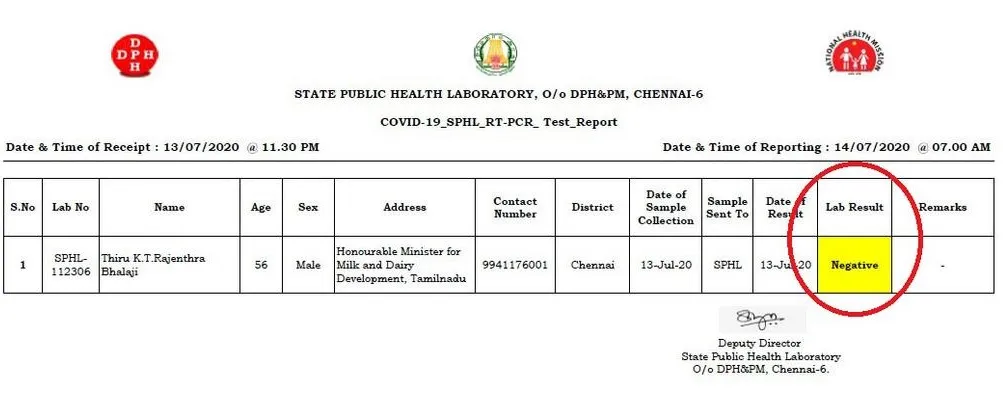 MINISTER RAJENDHRA BALAJI TESTS NEGATIVE IN CORONAVIRUS 