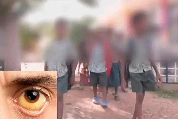  12 students with jaundice; Wayalogam village in fear