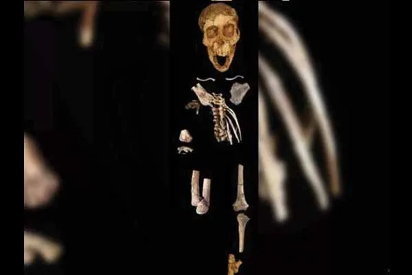 bone