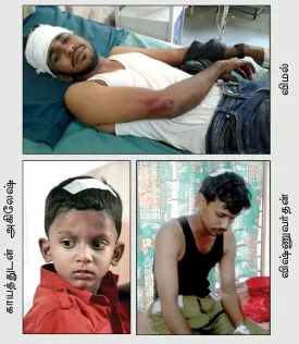 injuired people