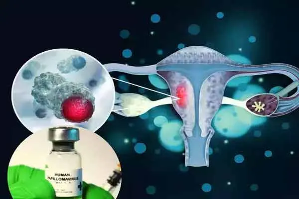 Cervical cancer vaccine at Rs.200; Introduced by Central Department of Biotechnology