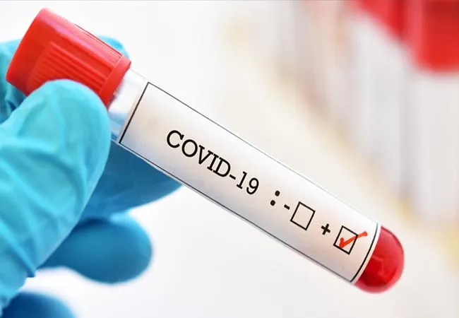 tamilnadu health department today covid cases 