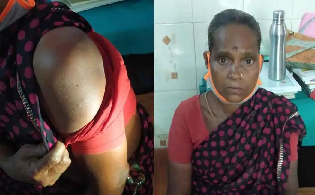 The nurse who gave two vaccines to the same woman while talking