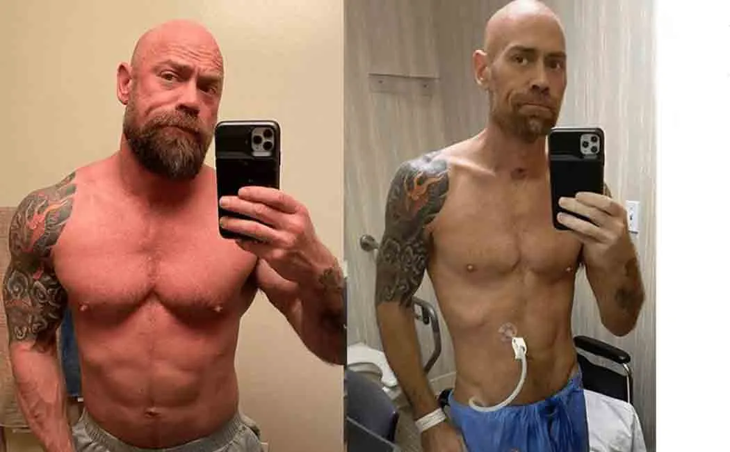 body transformation of a corona patient