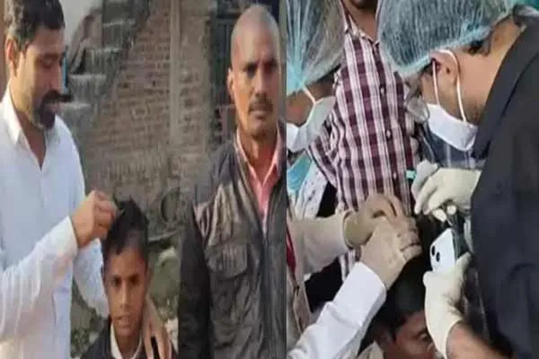 Shocking information in a study released Bald villagers in maharashtra
