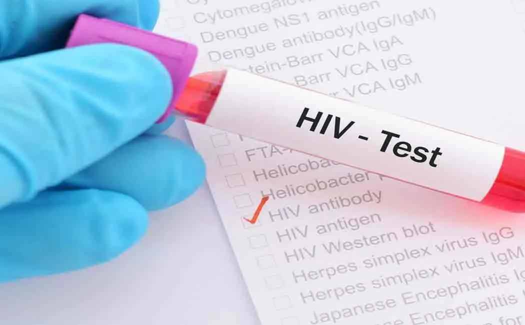 scientists successfully removed hiv virus from rat's blood