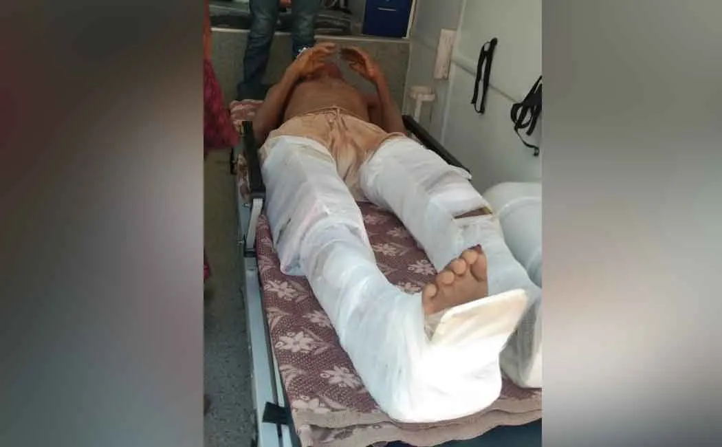 Elephant stepping on an old man .... legs broken