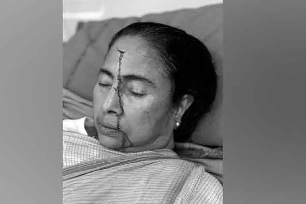 Doctor explains Mamata Banerjee's health