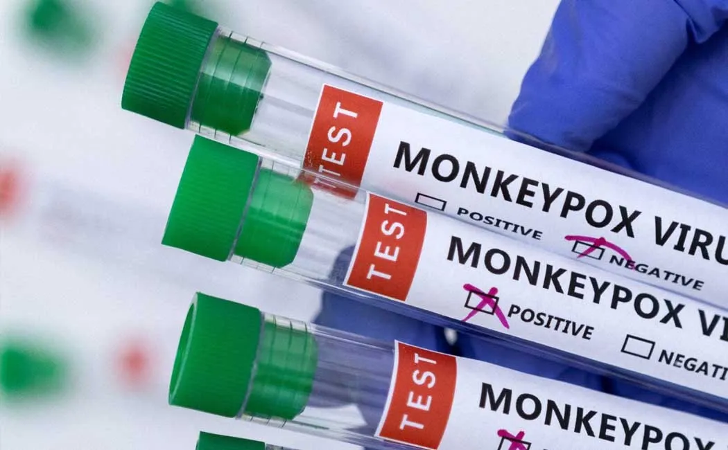 Monkey measles for a person who returned from Dubai to Kannur!