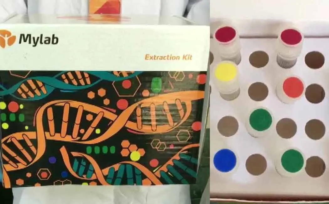 Pune based firm has developed India's first indigenous COVID19 testing kit