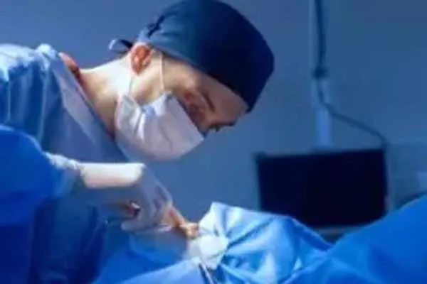doctors remove 2-kg hair from woman stomach