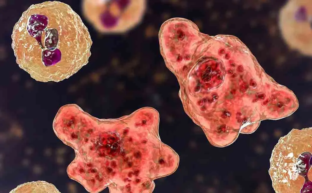 man in america affected by brain eating amoeba