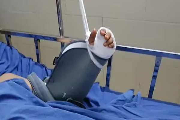 Seniors break the hand of an 11th grade student to ragging atrocity in Kerala