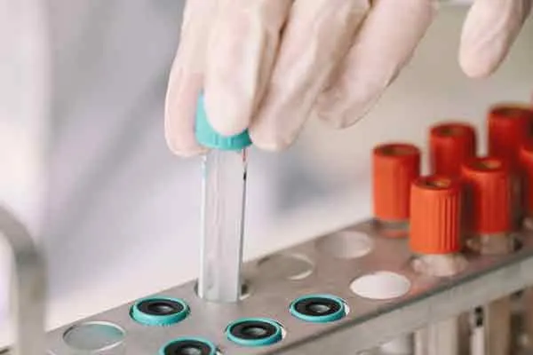 Corona test results issue 2 laboratories sealed in Salem ..!