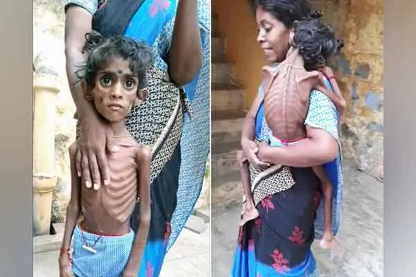 Fiver year old kid seeking medical emergency 