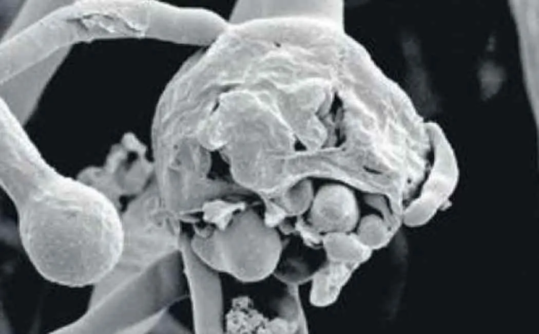 Medicine shortage for fungal diseases - relatives of patients suffering ..!