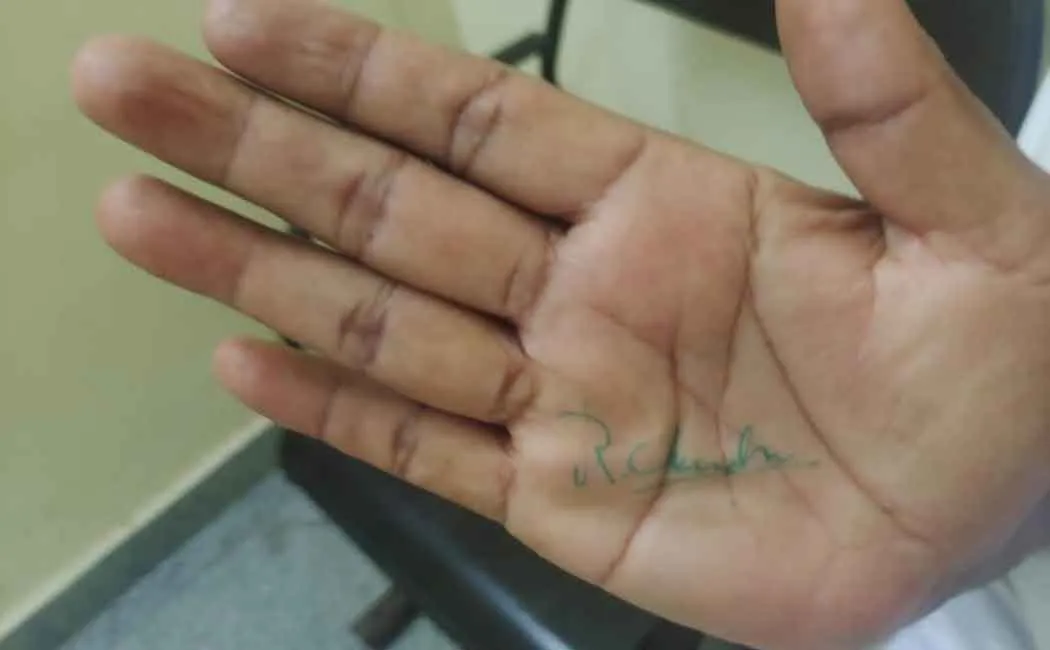 Commissioner signed in the palm of his hand asking for contract money