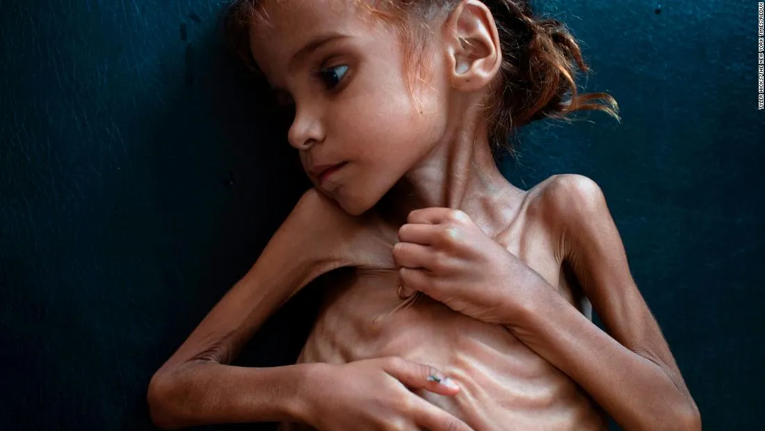 yemen