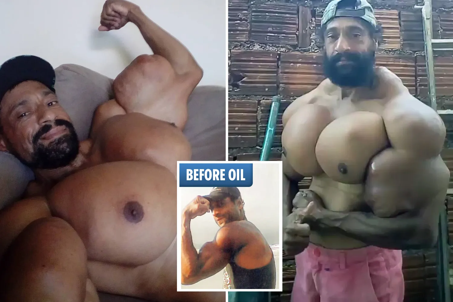 Bodybuilder becomes latest to risk death by injecting oil into his muscles  but swears his ridiculous pics are the real deal