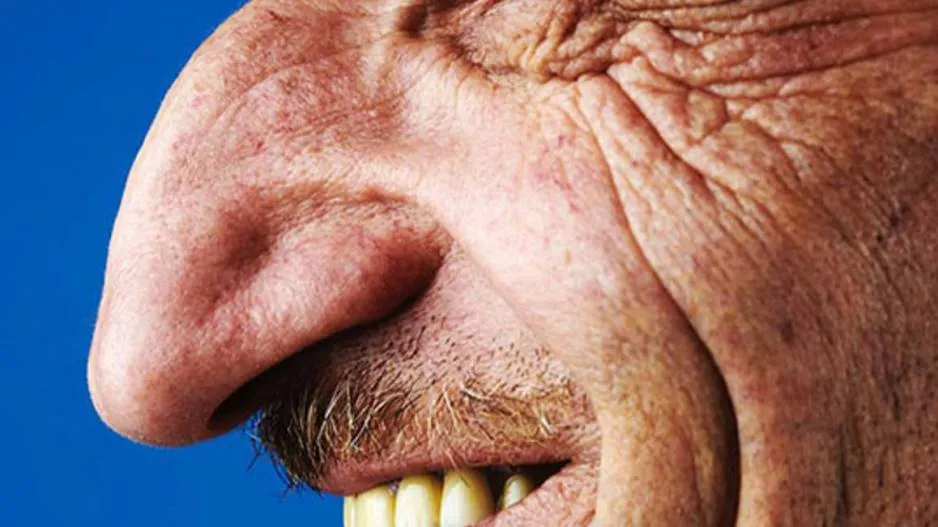 Worlds biggest nose