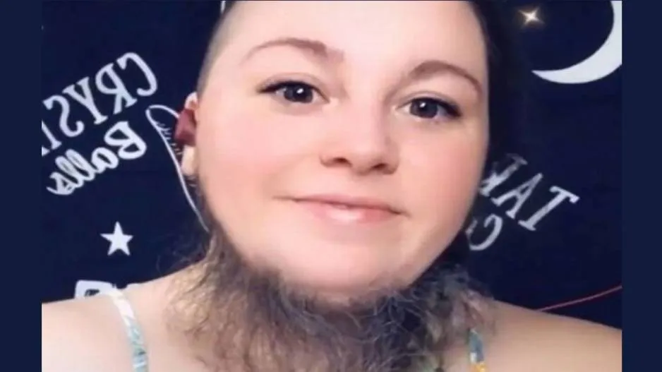 Bearded woman inundated by male