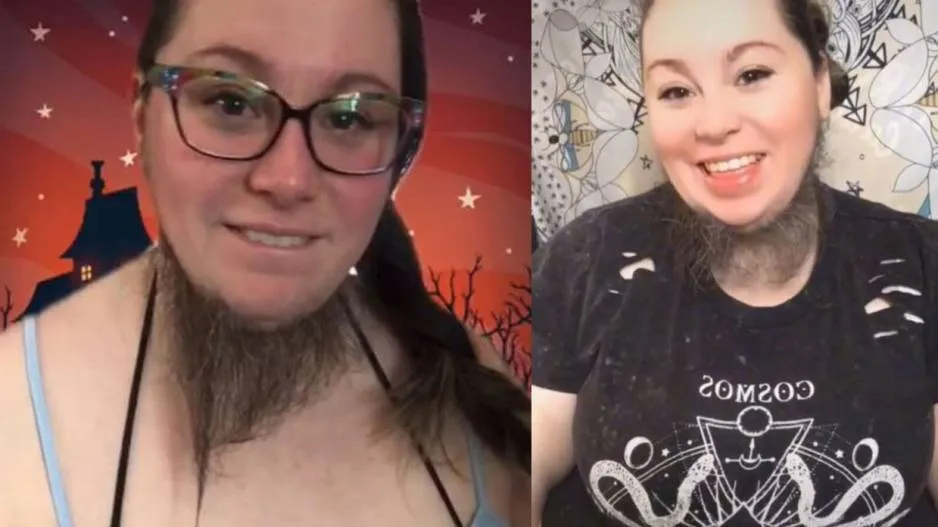 Bearded woman inundated by male