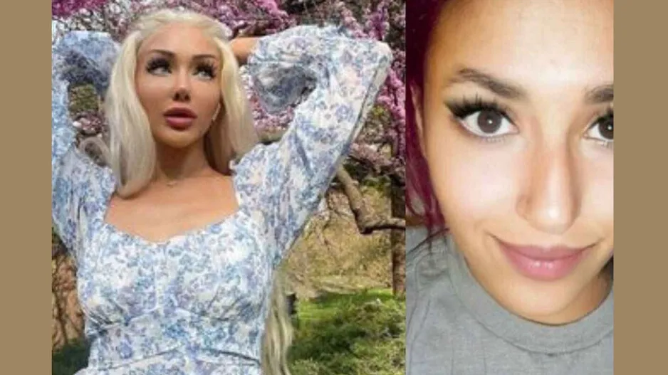 The young woman lost her beauty at spent  Rs 10 lakh