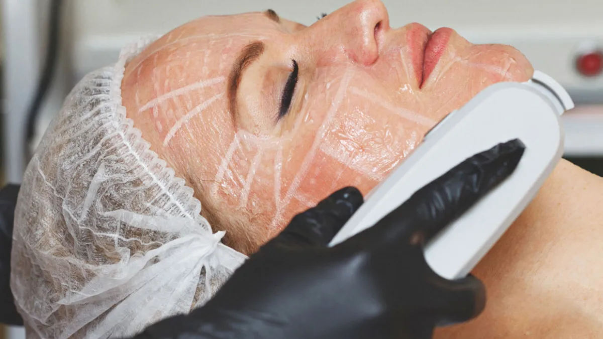 Hifu: Makes the face smooth and glow