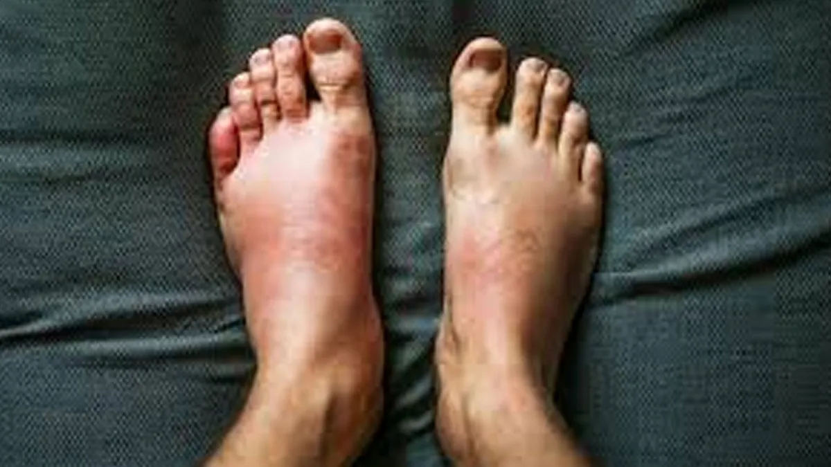 Some main signs of weak heart don’t avoid it