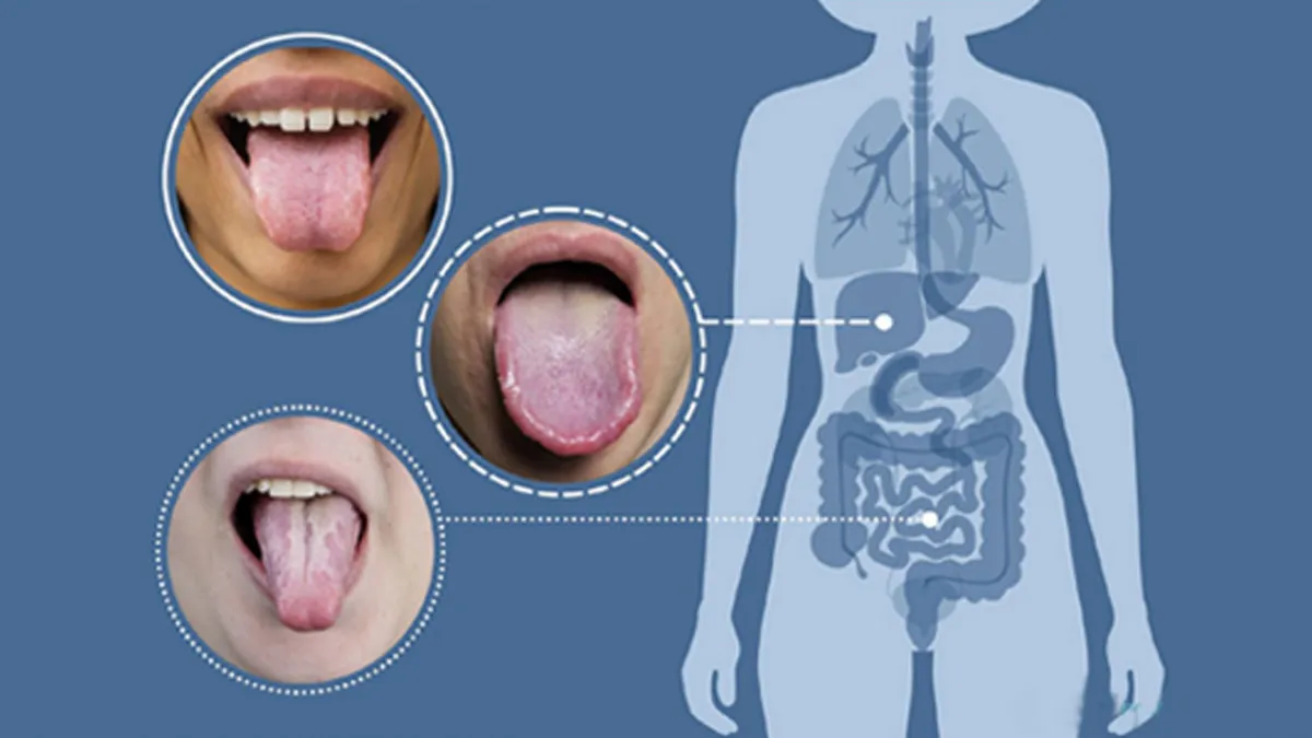 Changes in tongue color can indicate underlying health issue 