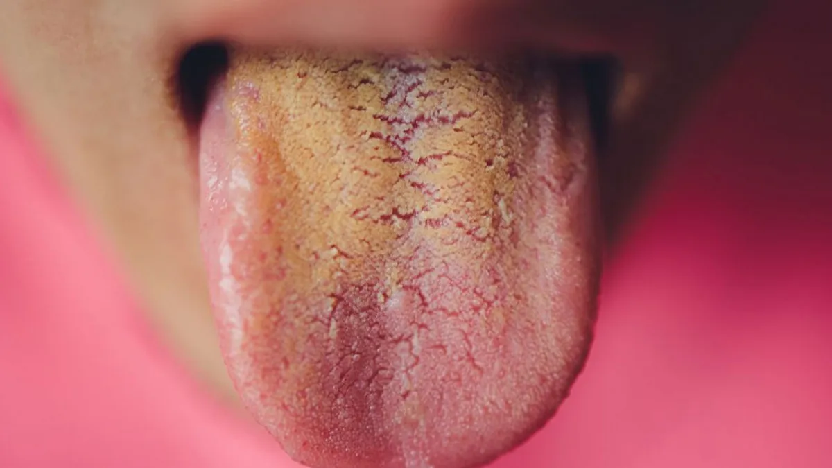 Changes in tongue color can indicate underlying health issue 