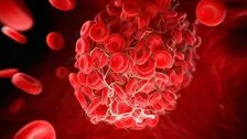 Scientists Discover COVID's Link To Life Threatening Blood Clots