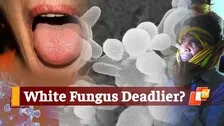 After Mucormycosis, Concerns Raised Over White Fungus Infection