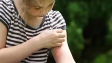 Know why mosquitoes bite you