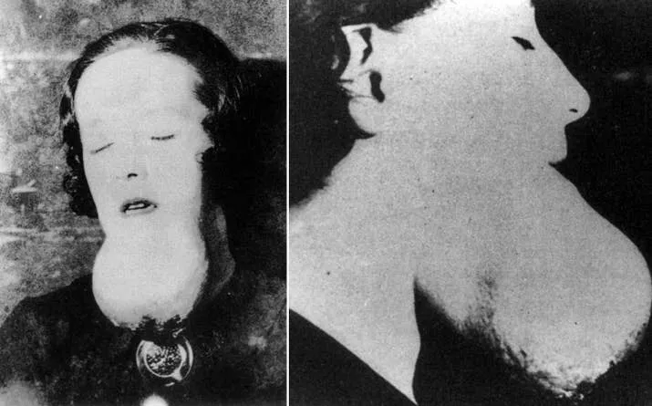 Radium Girls 2